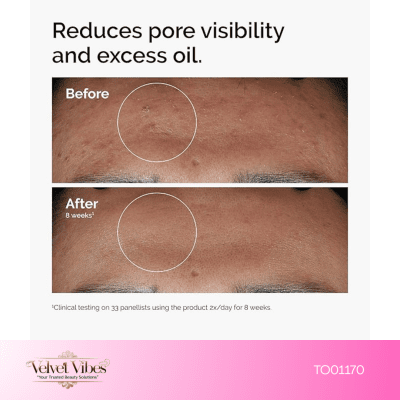 Niacinamide 10% + Zinc 1% – 30mL