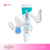 Acne Control Gel – 40mL